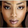 Skin Brightening