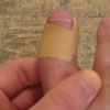 Nail Treatment
